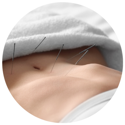Acupuntura
