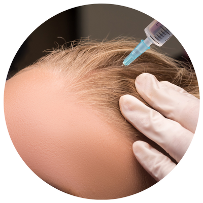 Mesoterapia Capilar