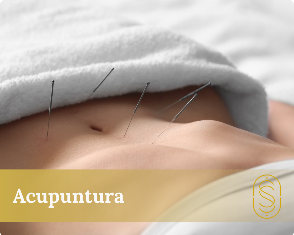 Acupuntura