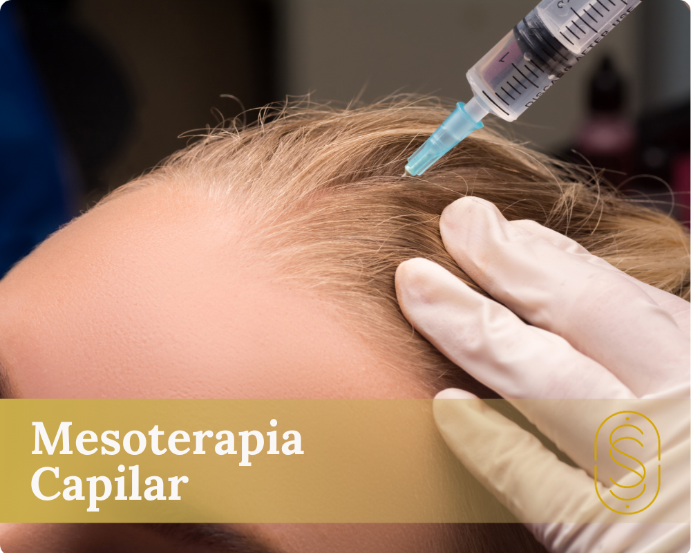 Mesoterapia Capilar