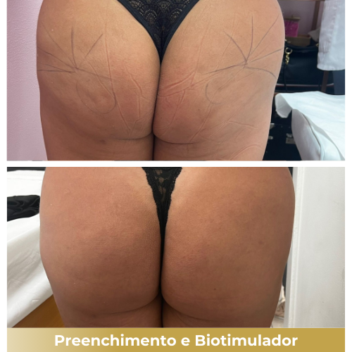 foto18