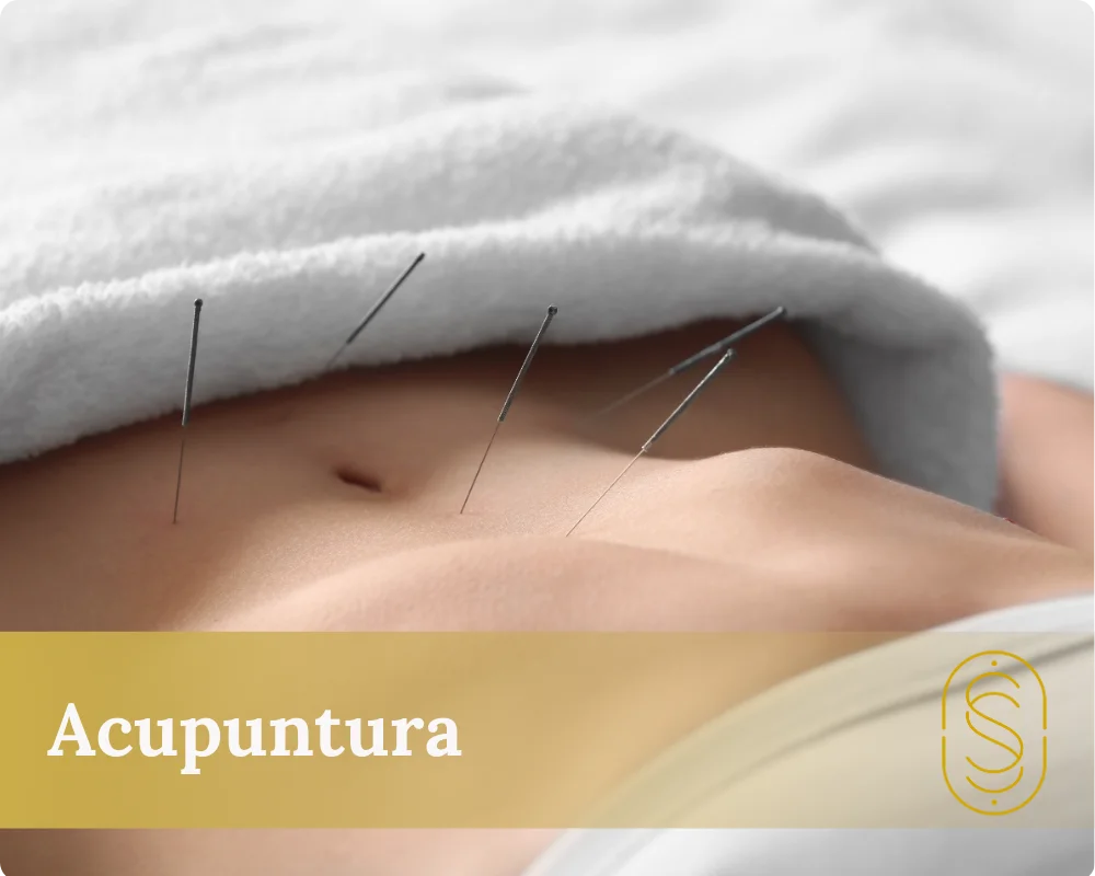 Acupuntura