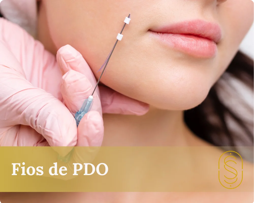 Fios de PDO